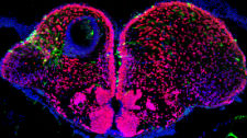 Developmental Neurobiology